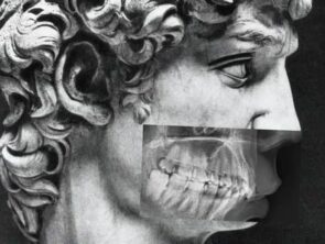 Цифровая ортопантомография